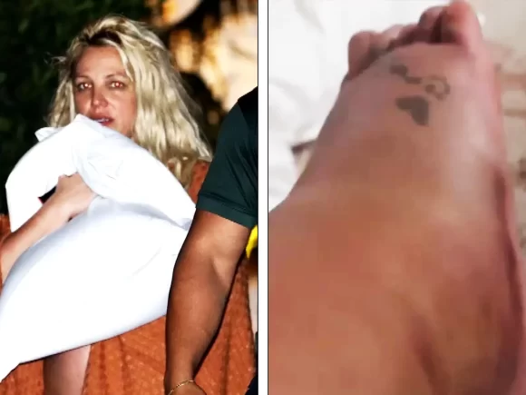 Britney Spears said that after the hotel incident, her foot is broken