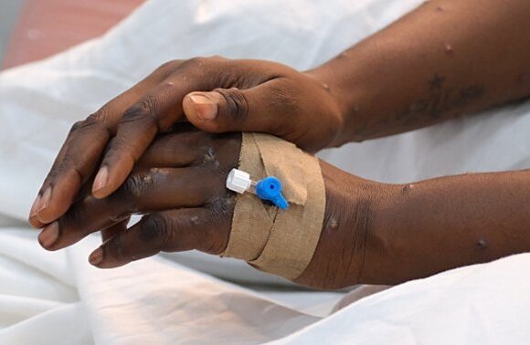 Africa CDC says that Mpox is still not under control on the continent