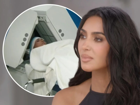 Kim Kardashian Has Suffered  a Brain Aneurysm
