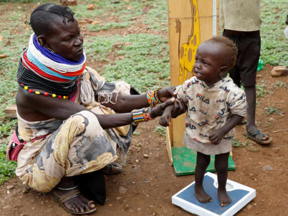 U.S. aid cuts prevent hungry children in Kenya from receiving life-saving care