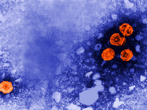 Guinea-Bissau halts vaccine study backed by the Trump administration