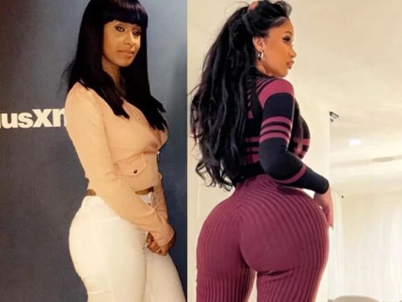Cardi B Cancels Butt Reduction Surgery Plans; Here’s What Happened
