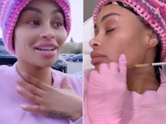 Blac Chyna has made a significant change: she has removed the implants, the shots, and the fillers; all of it is gone