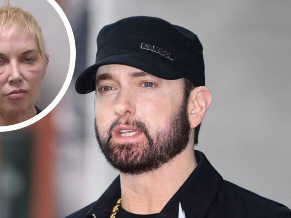 Eminem’s ex, Kim Scott, faces another health challenge following her DUI arrest