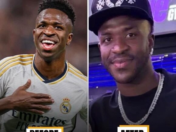 Vinicius Junior Reveals Fresh Appearance Following Cosmetic Chin Procedure